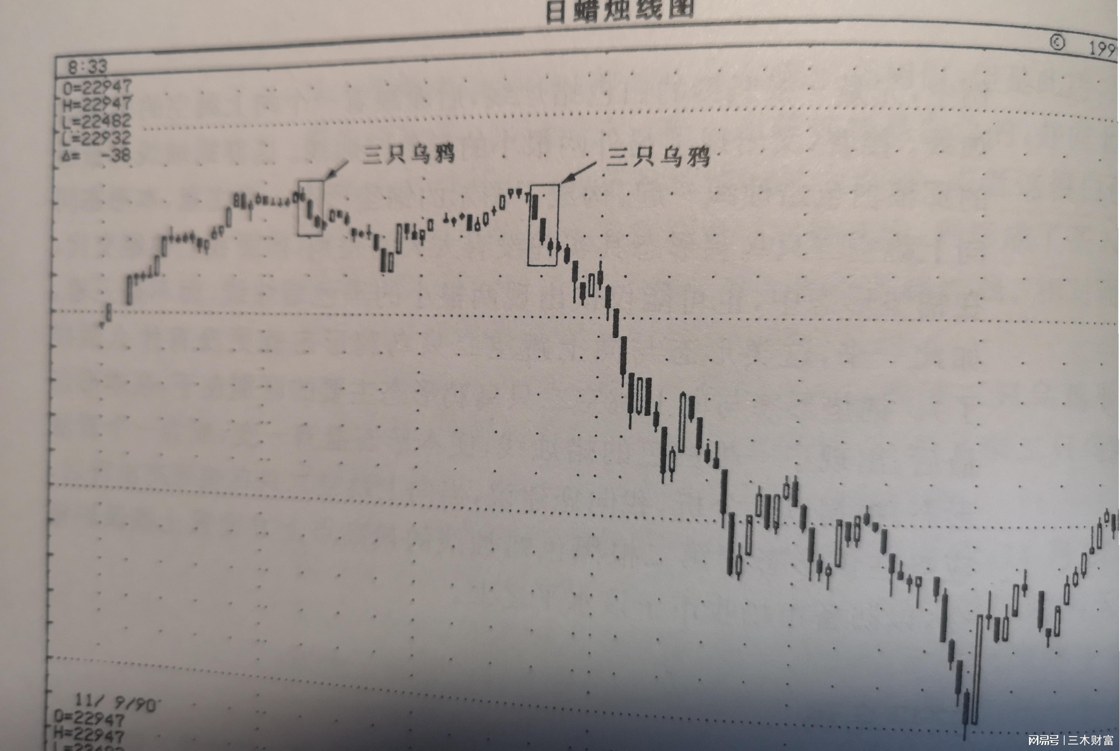 孕线形态