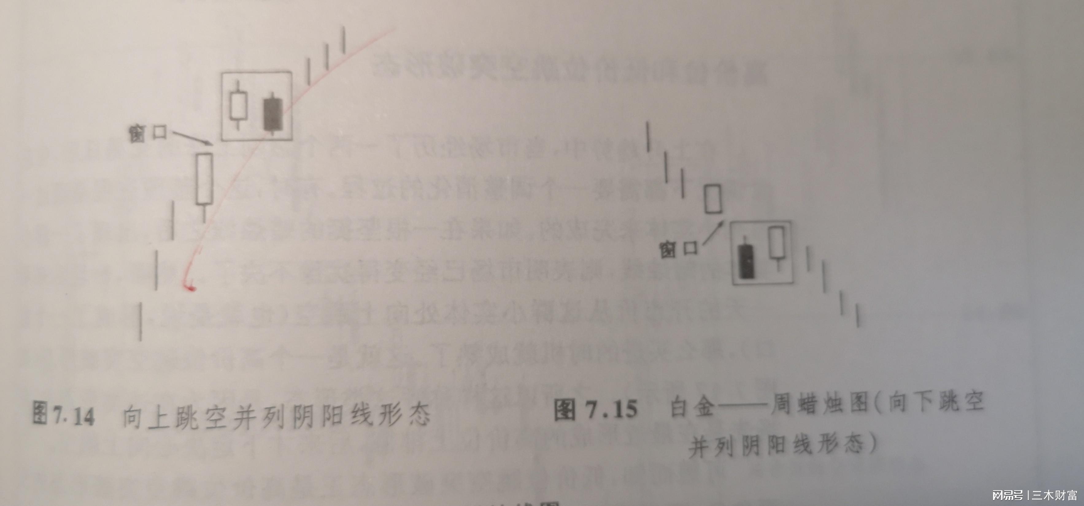 孕线形态