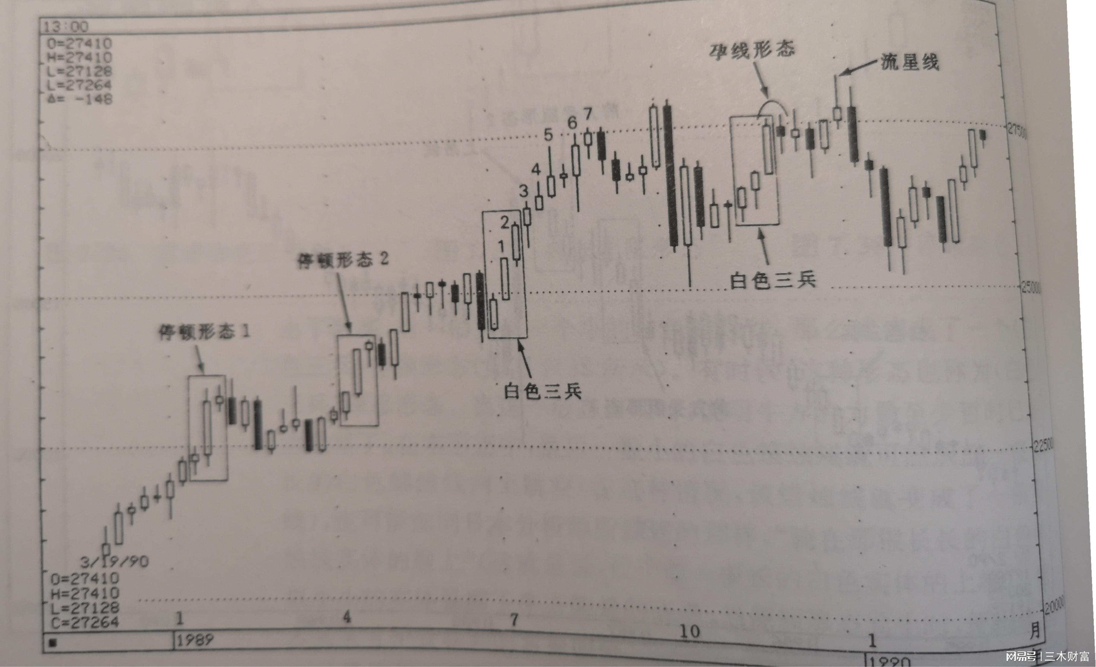 孕线形态