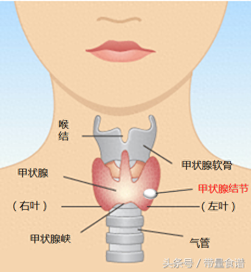 甲亢算是大病吗