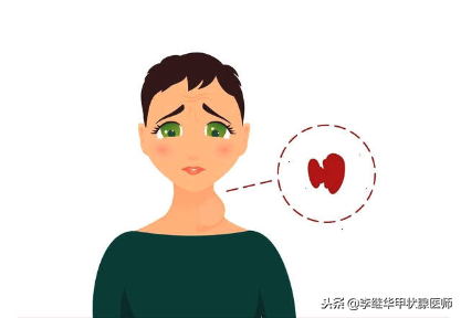 甲亢算是大病吗