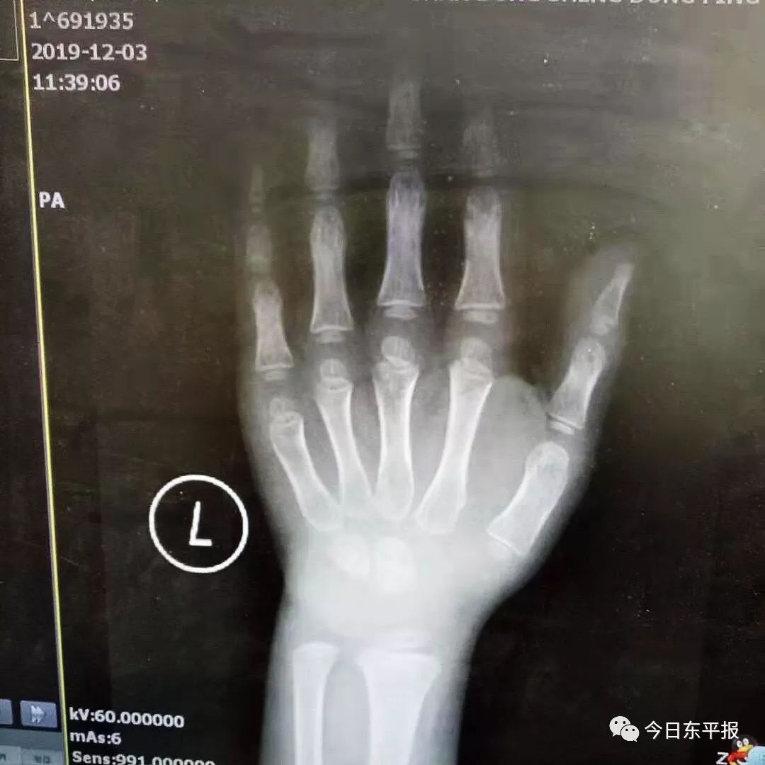 打生长激素可以报销吗