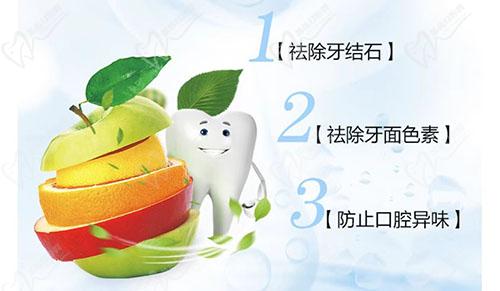 厦门登特口腔洗牙优势
