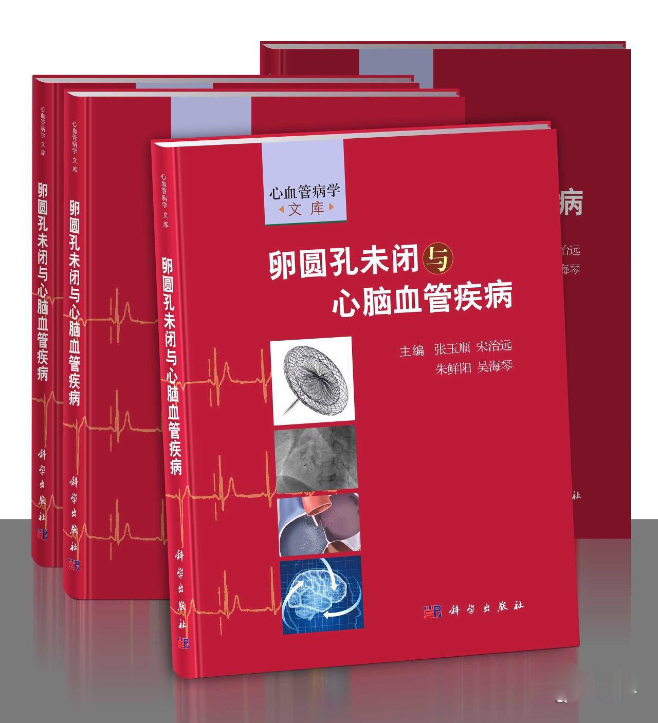 卵圆孔未闭属于大病吗