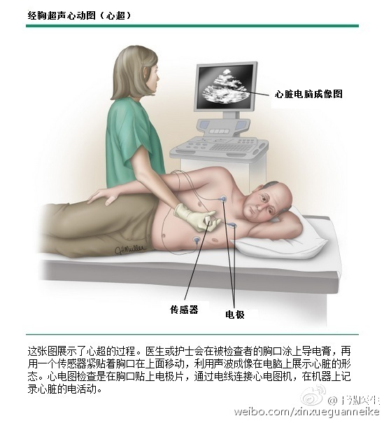 卵圆孔未闭属于大病吗